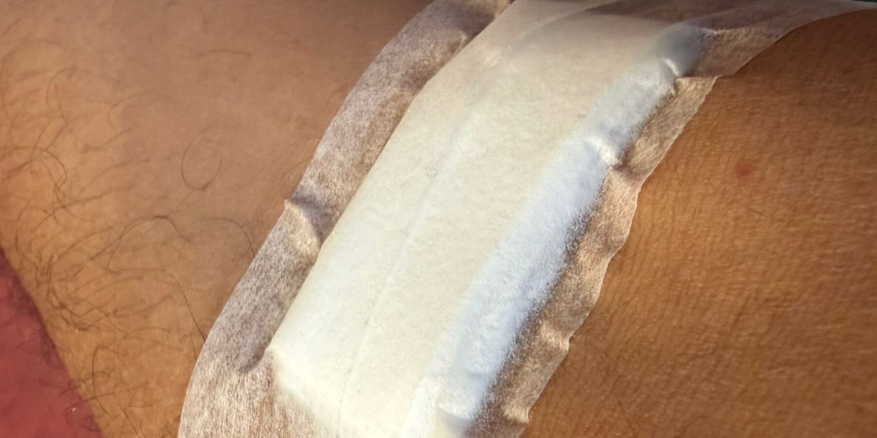 Pleister na het bloedprikken.